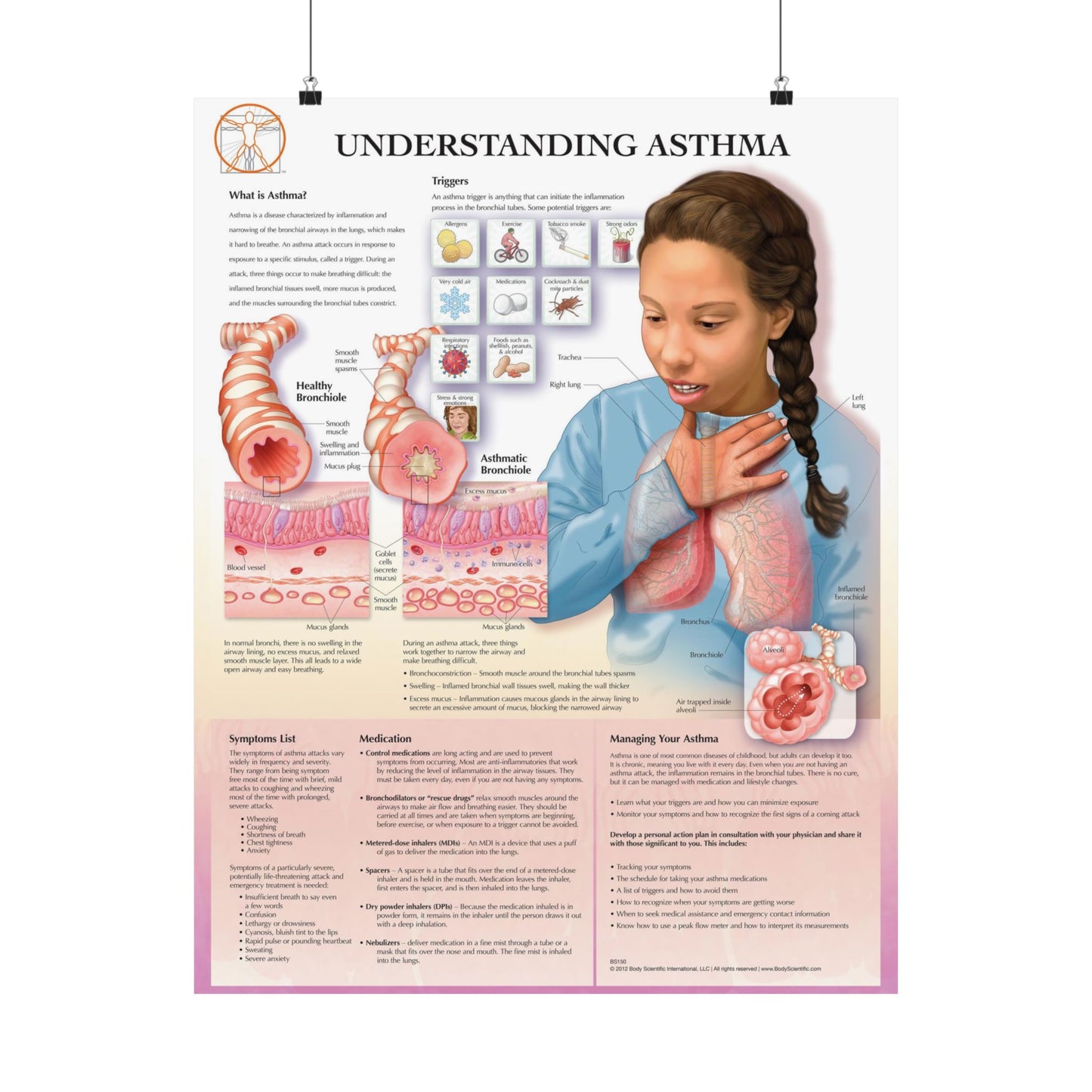 Understanding Asthma