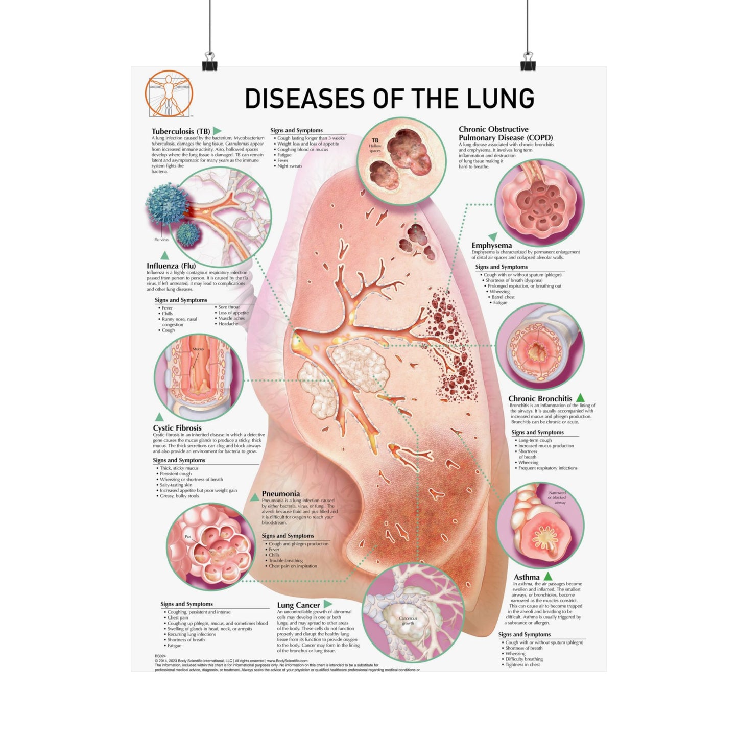 Diseases of the Lung