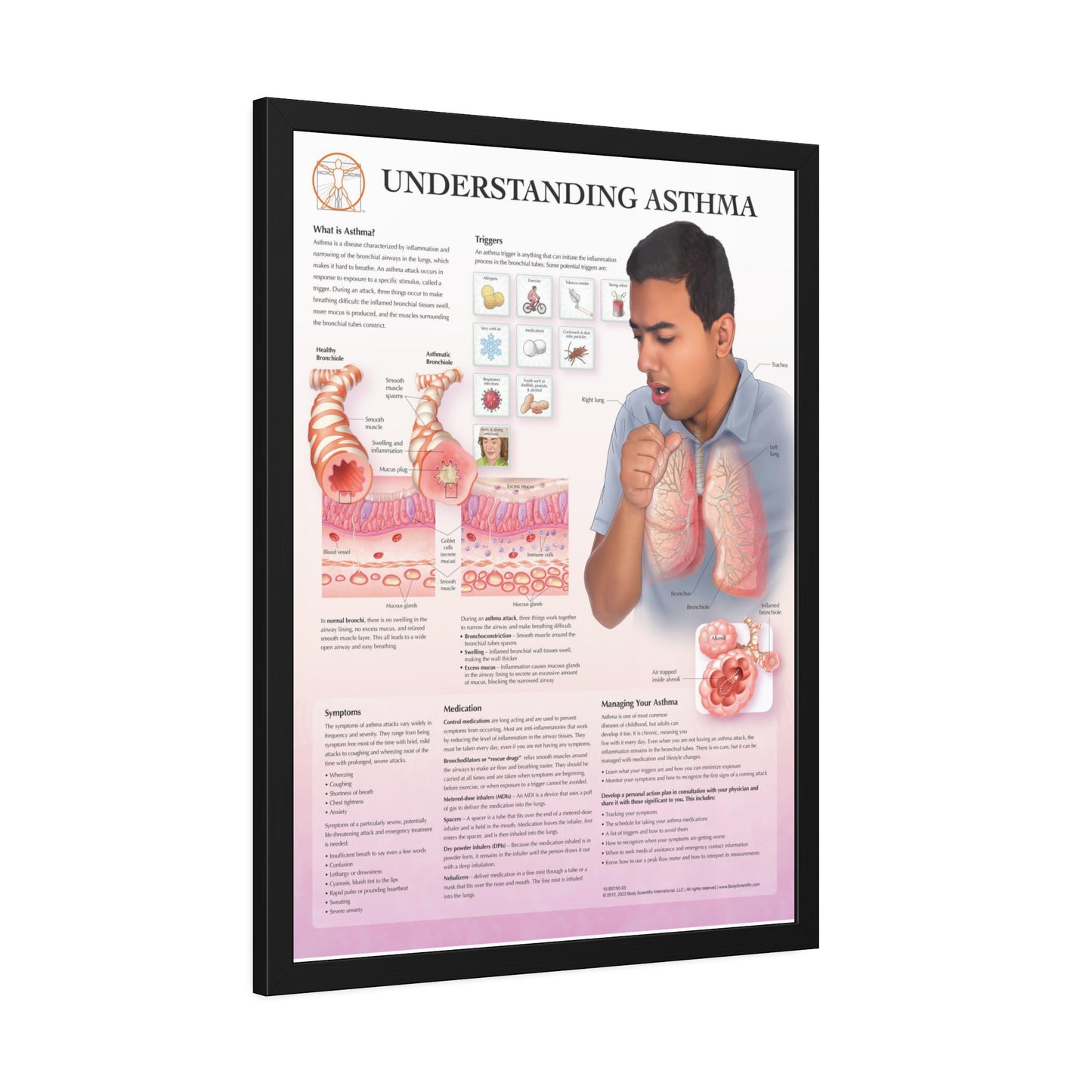 Framed Understanding Asthma