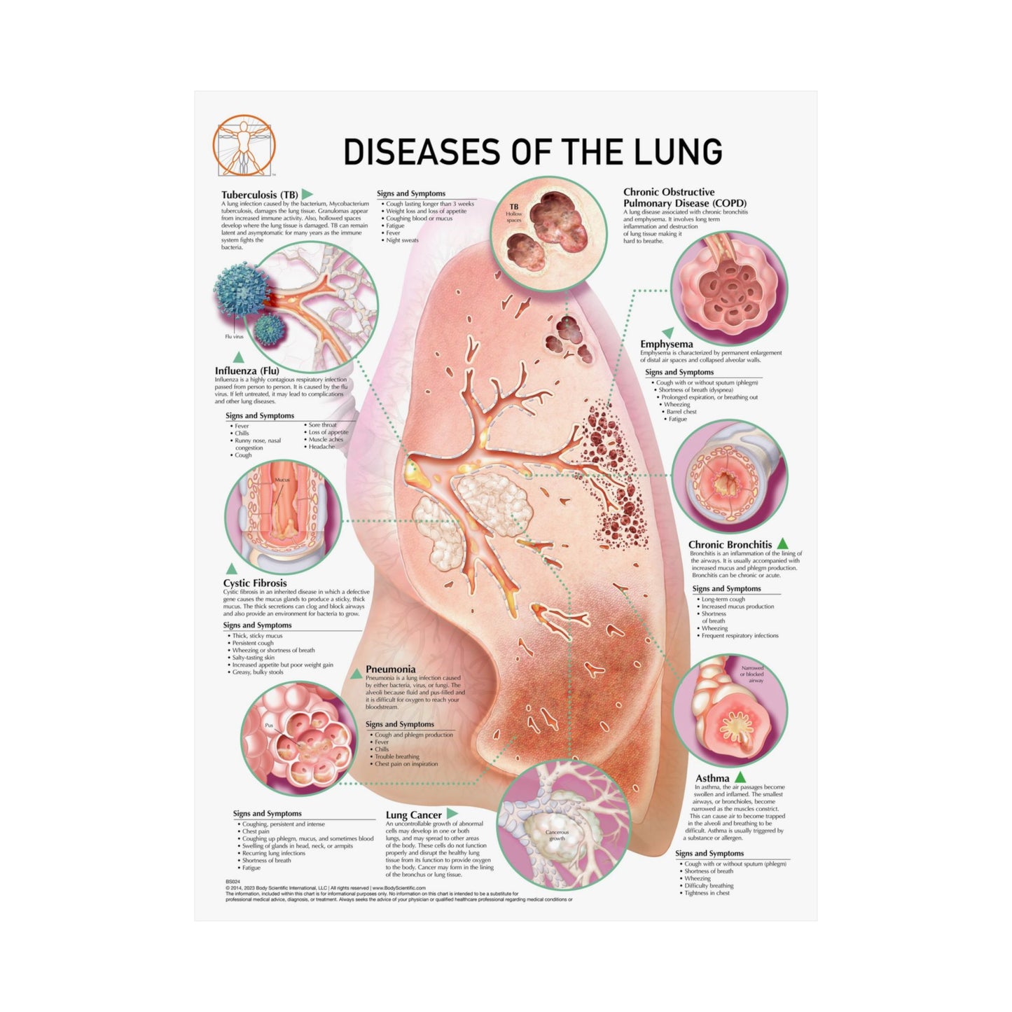 Diseases of the Lung