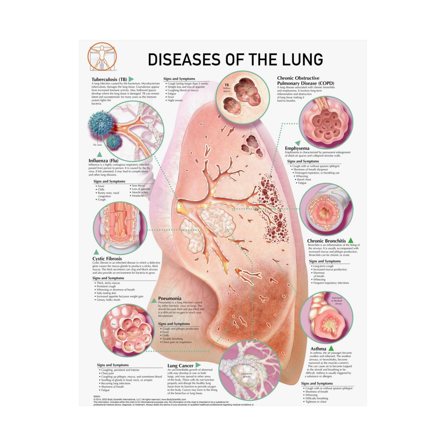 Diseases of the Lung