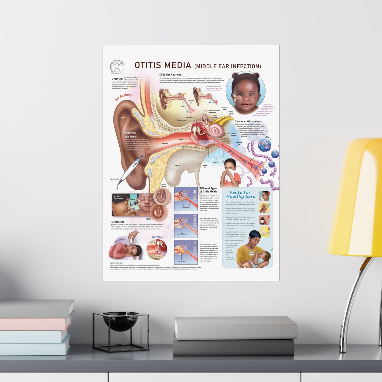 Otitis Media - Poster