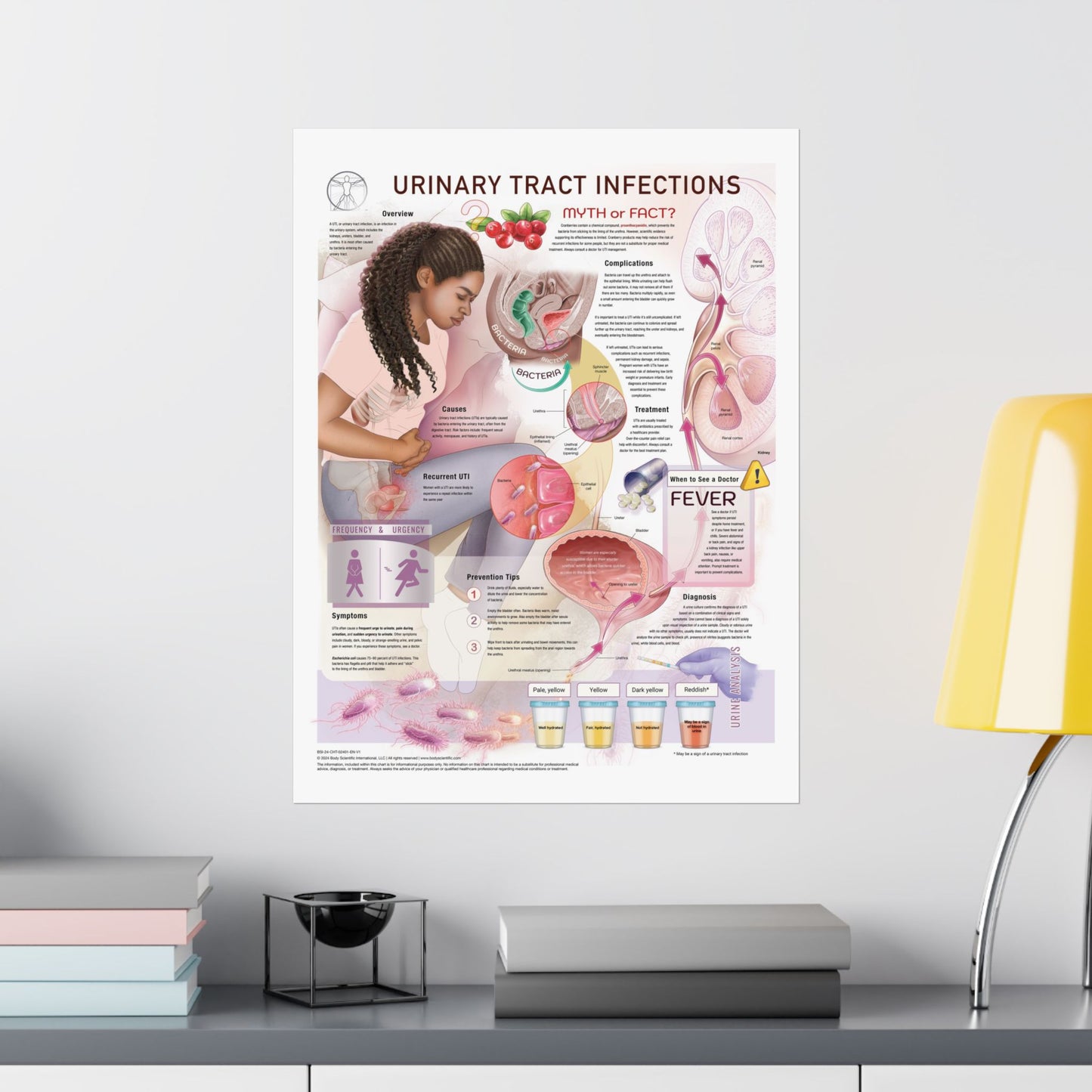 Urinary Tract Infections (UTI's)