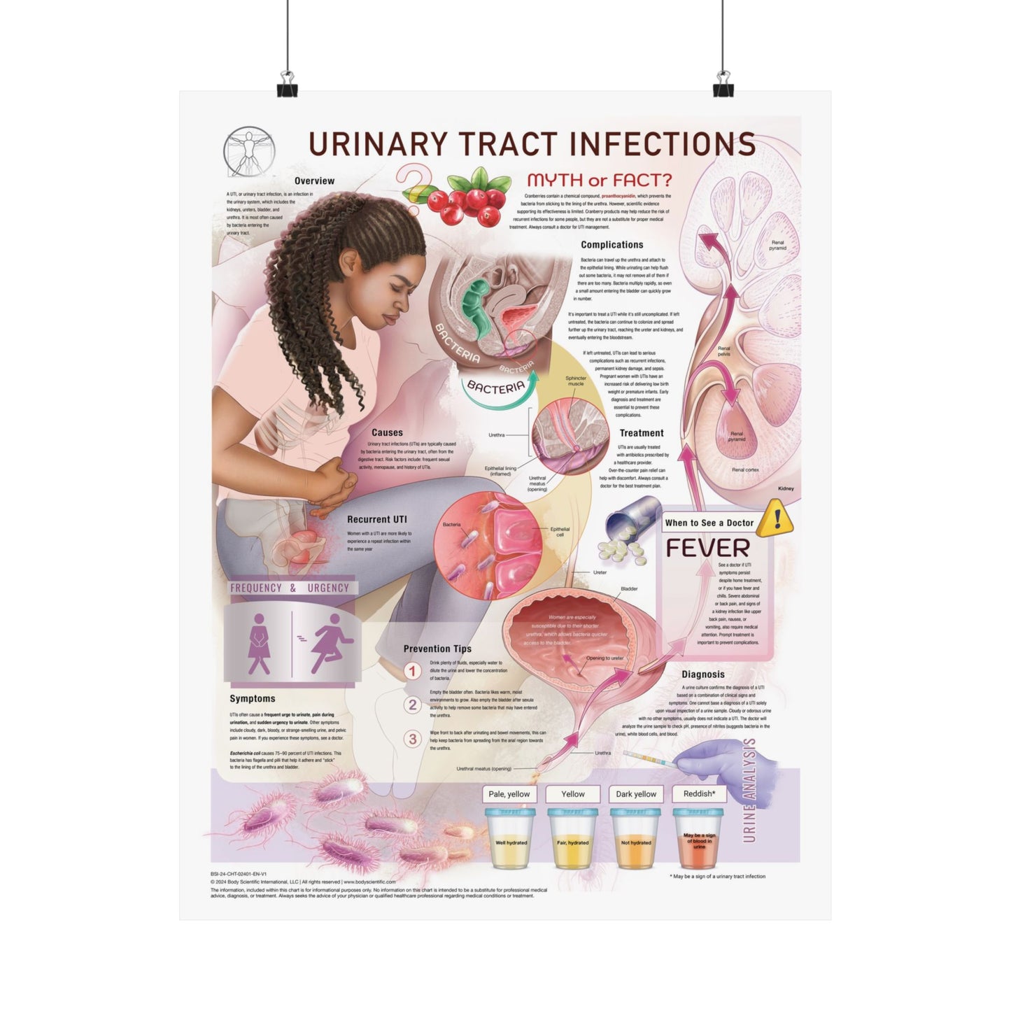 Urinary Tract Infections (UTI's)