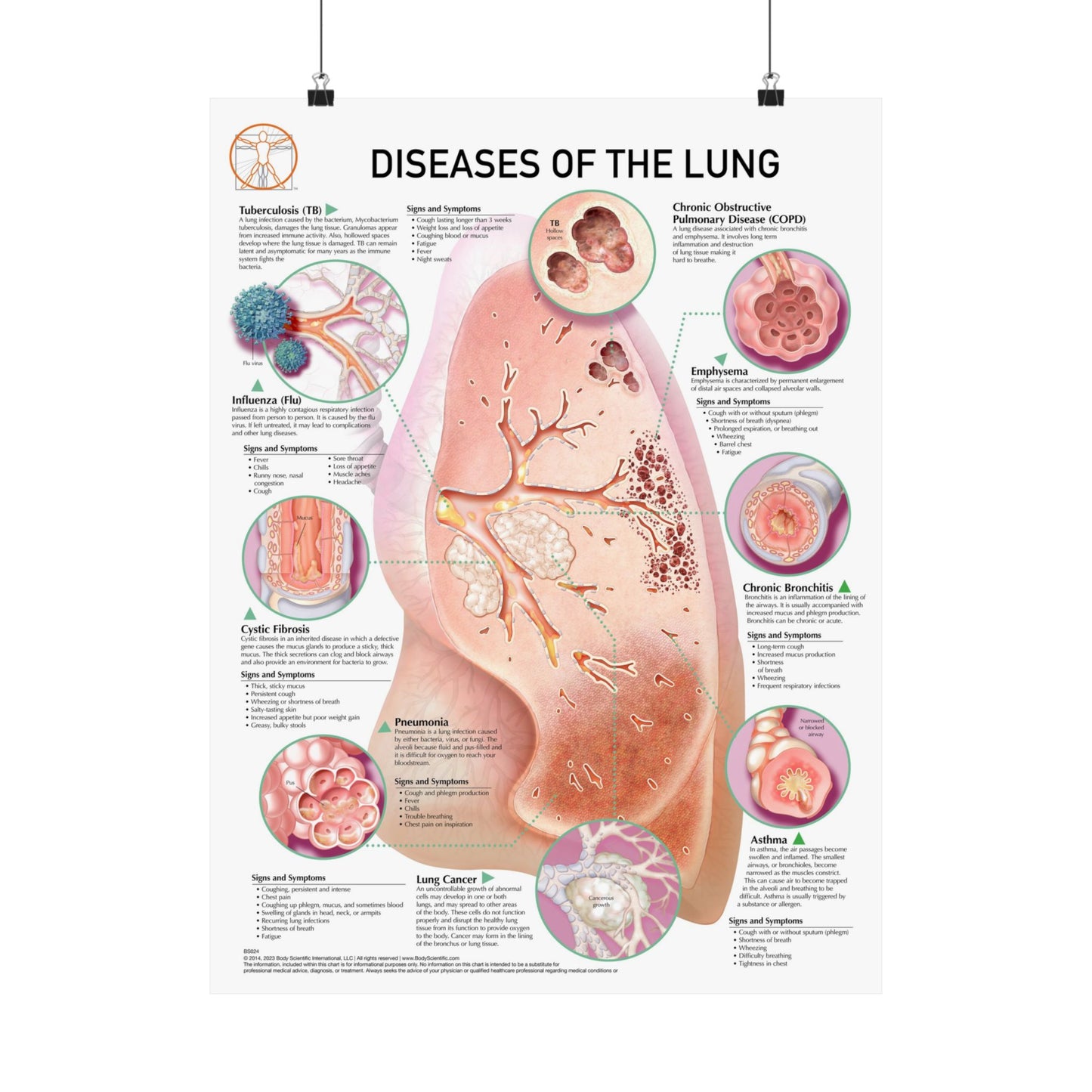 Diseases of the Lung