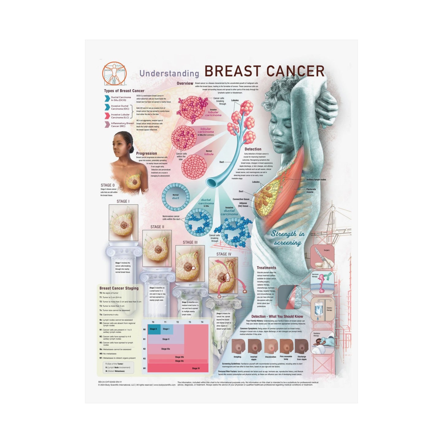 Understanding Breast Cancer