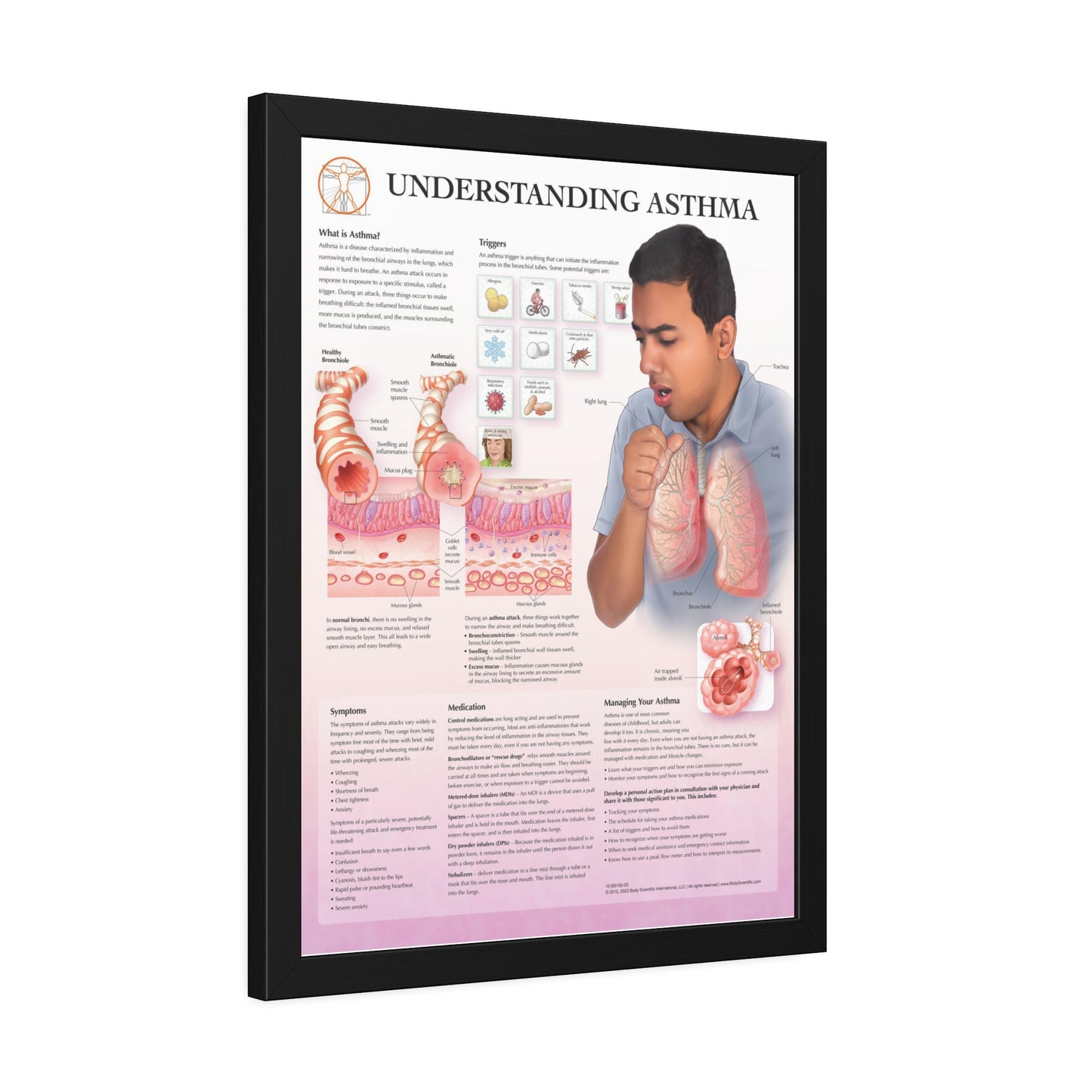 Framed Understanding Asthma