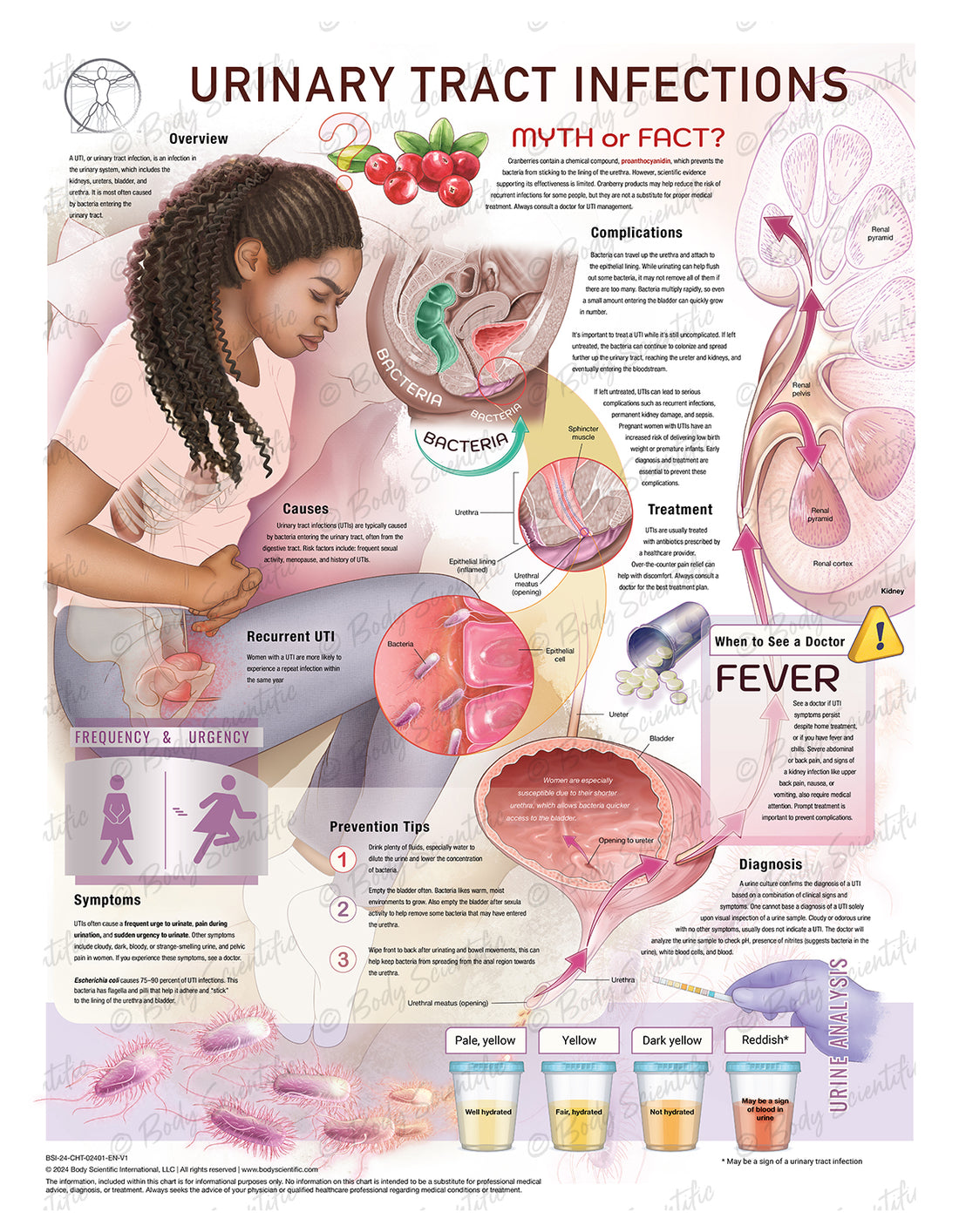 Urinary Tract Infection Anatomical Chart