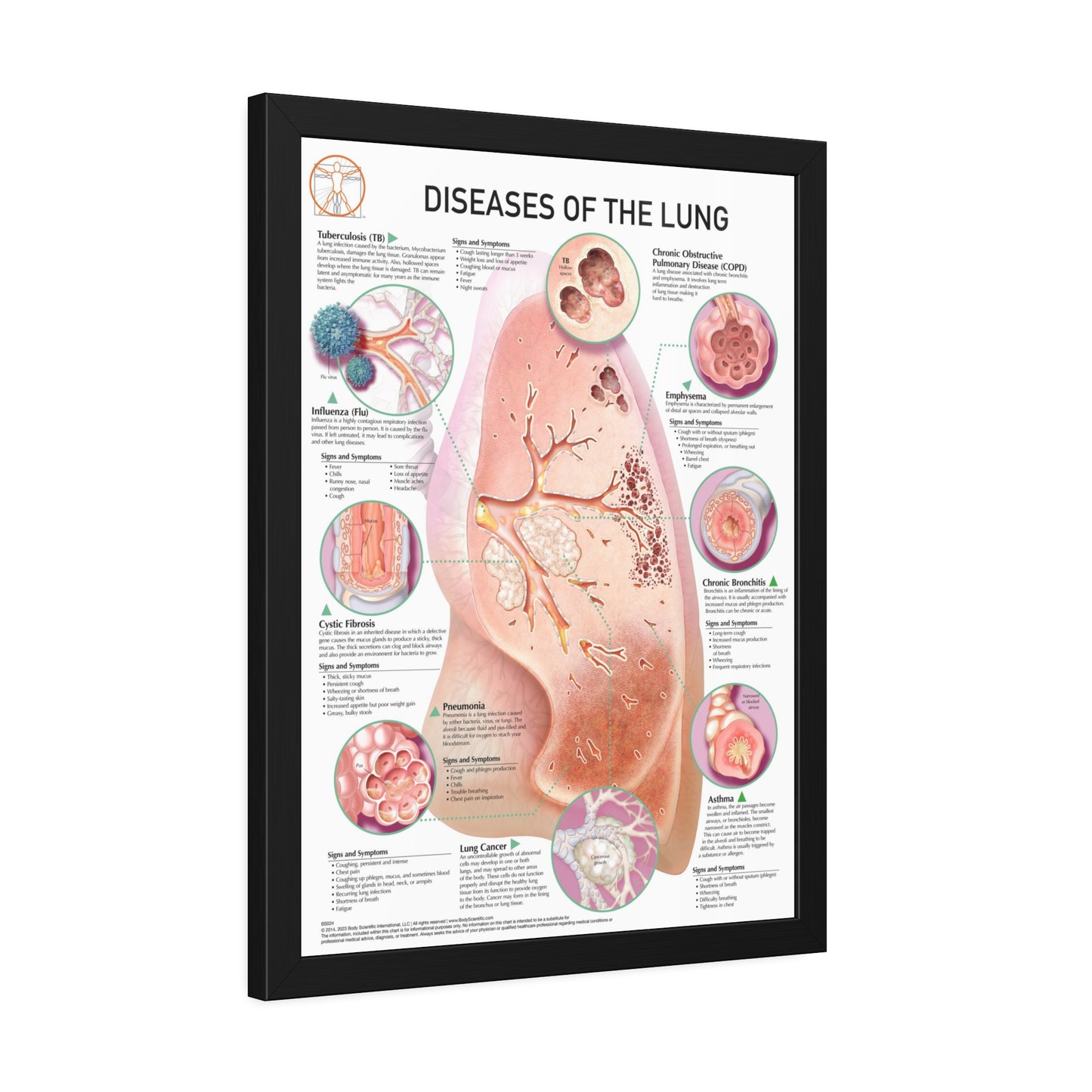 Disease of the lung