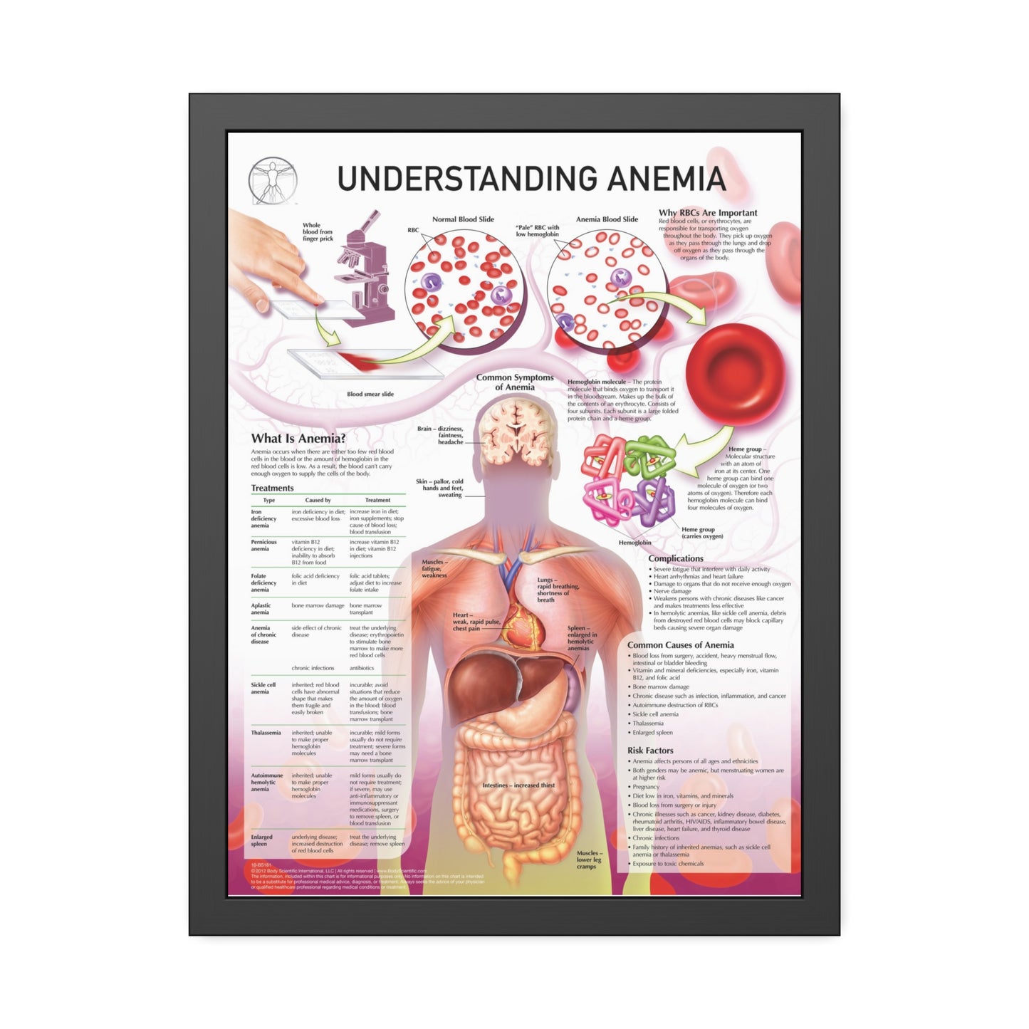 Understanding Anemia