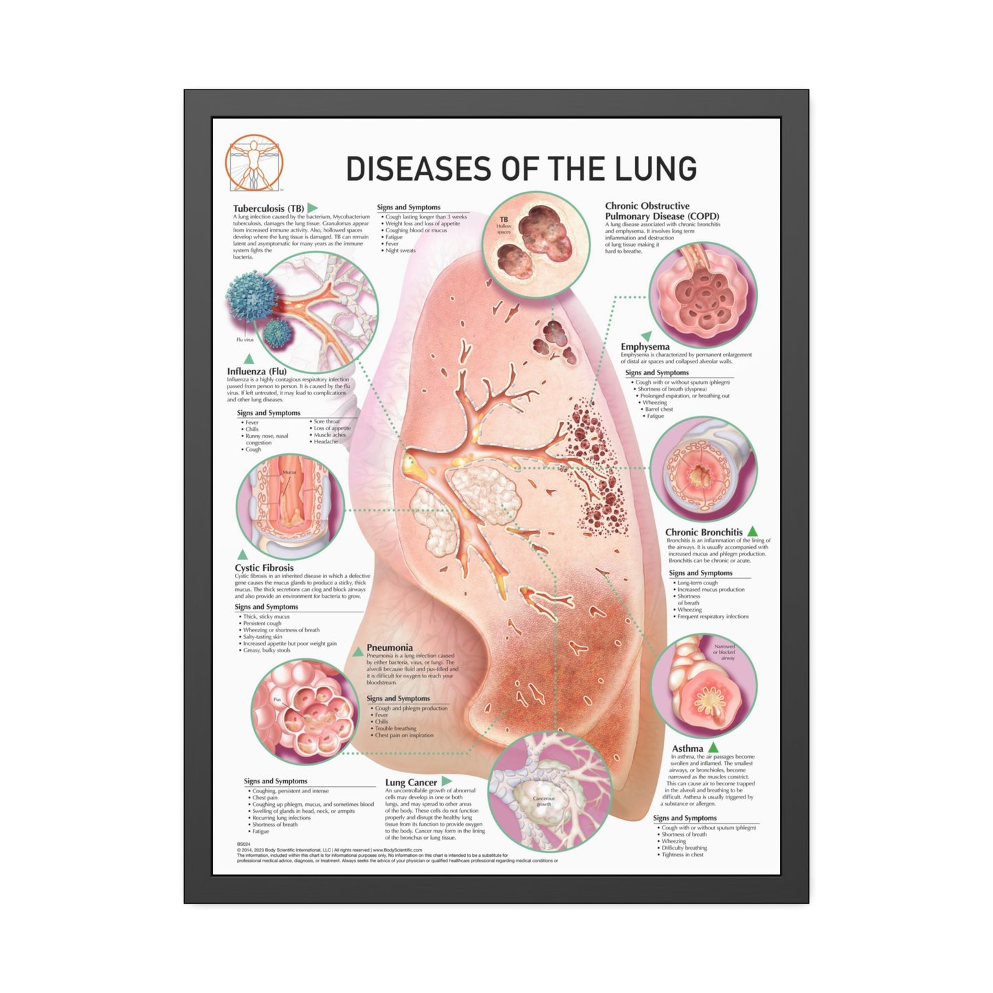 Disease of the lung