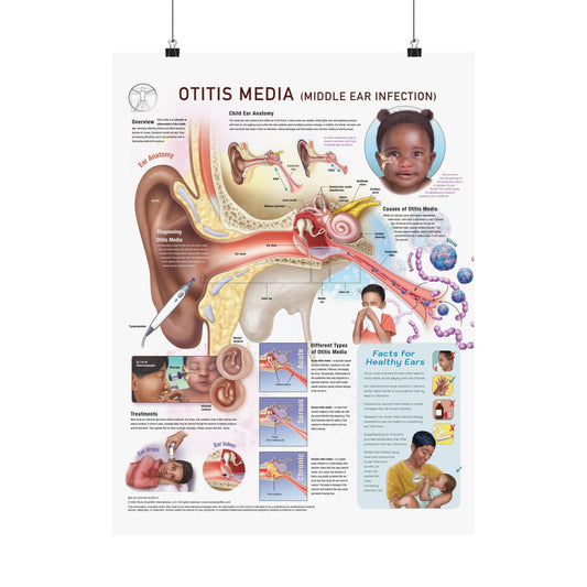 Otitis Media - Poster