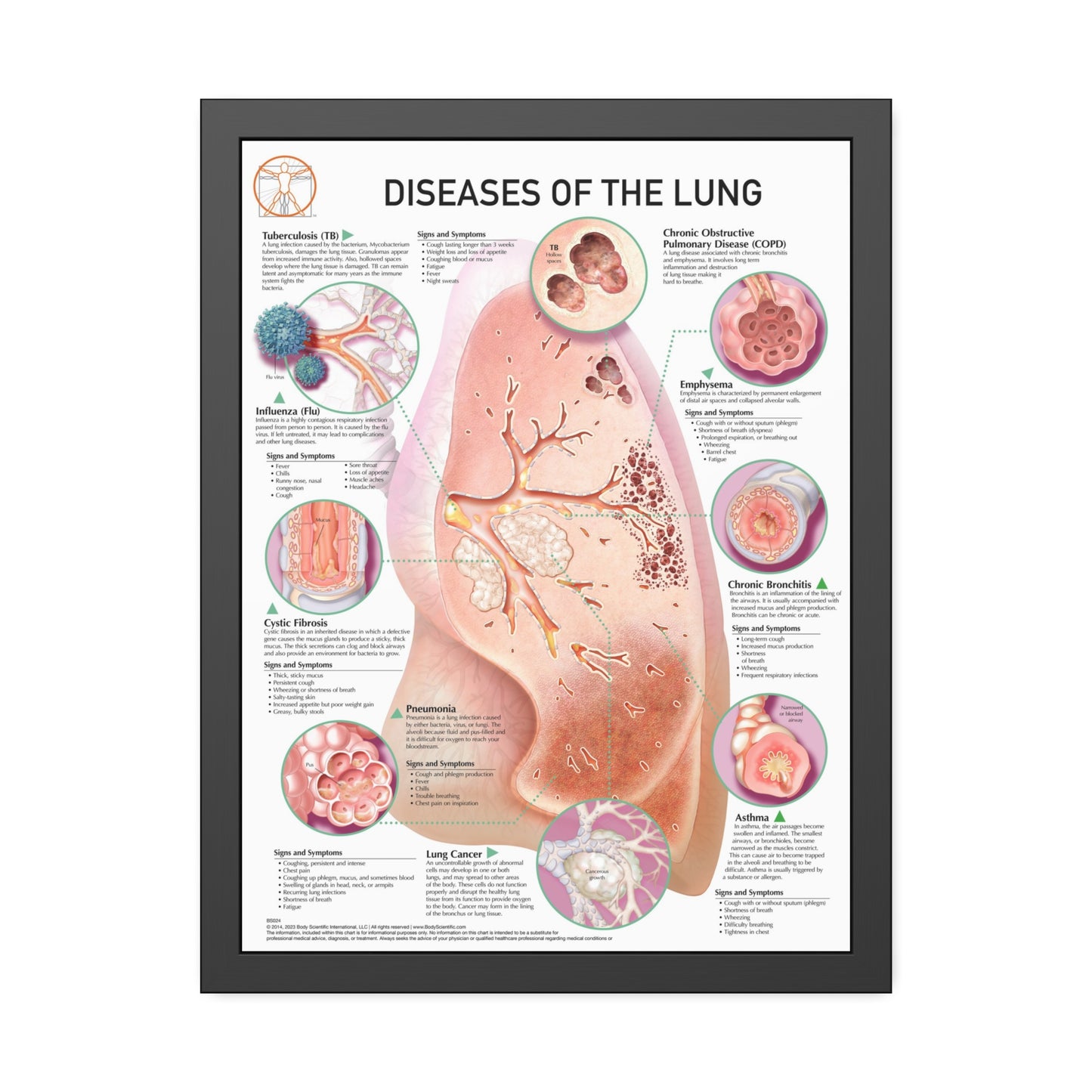 Disease of the lung