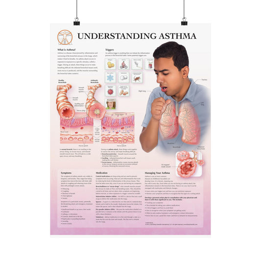 Understanding Asthma