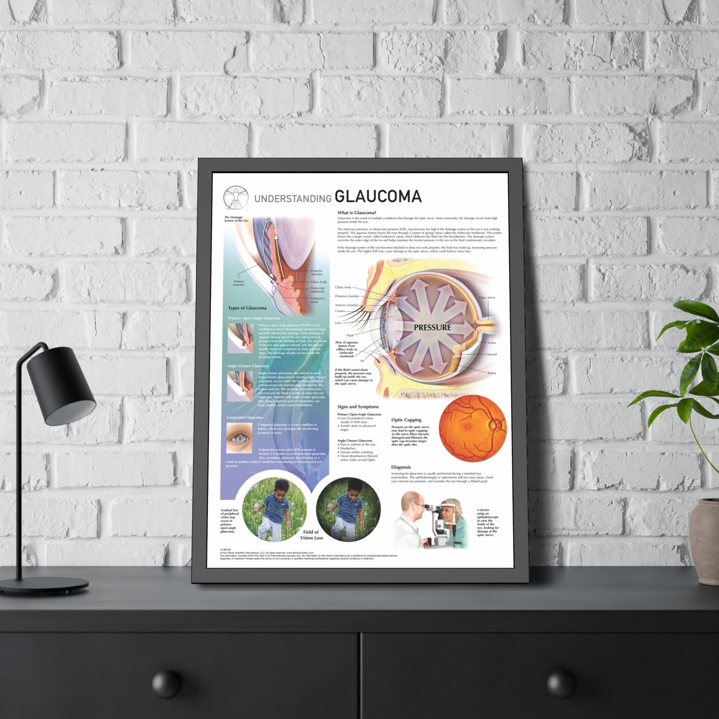 Understanding Glaucoma