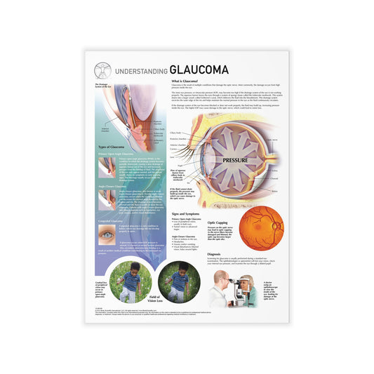 Understanding Glaucoma - Decal