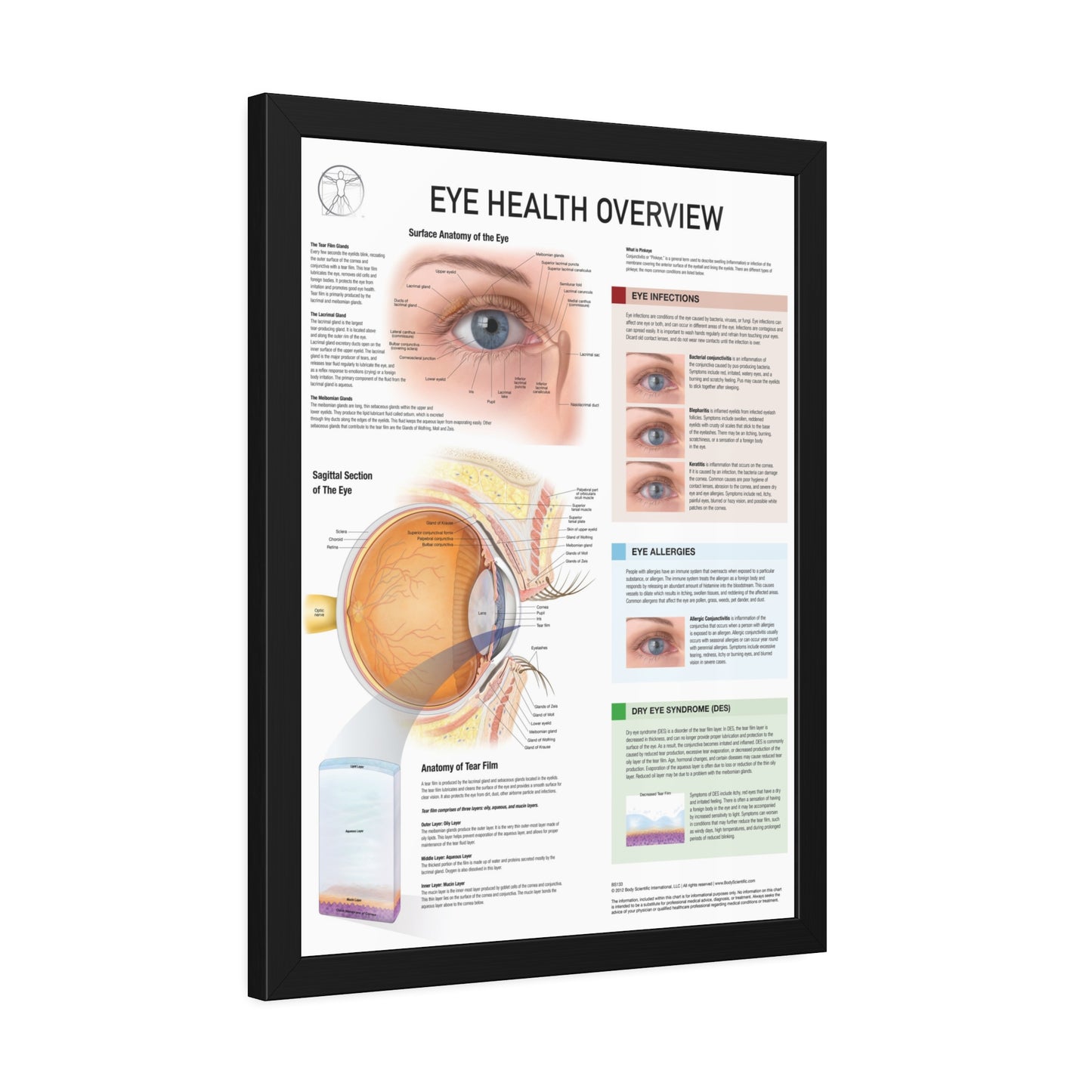 Eye Health Overview