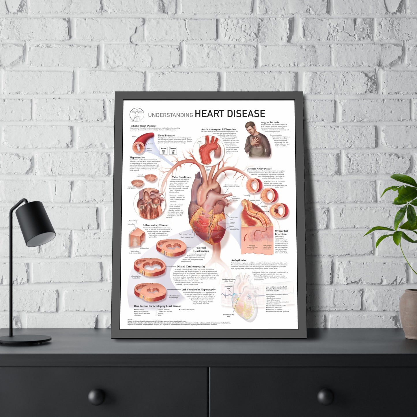 Understanding Heart Disease