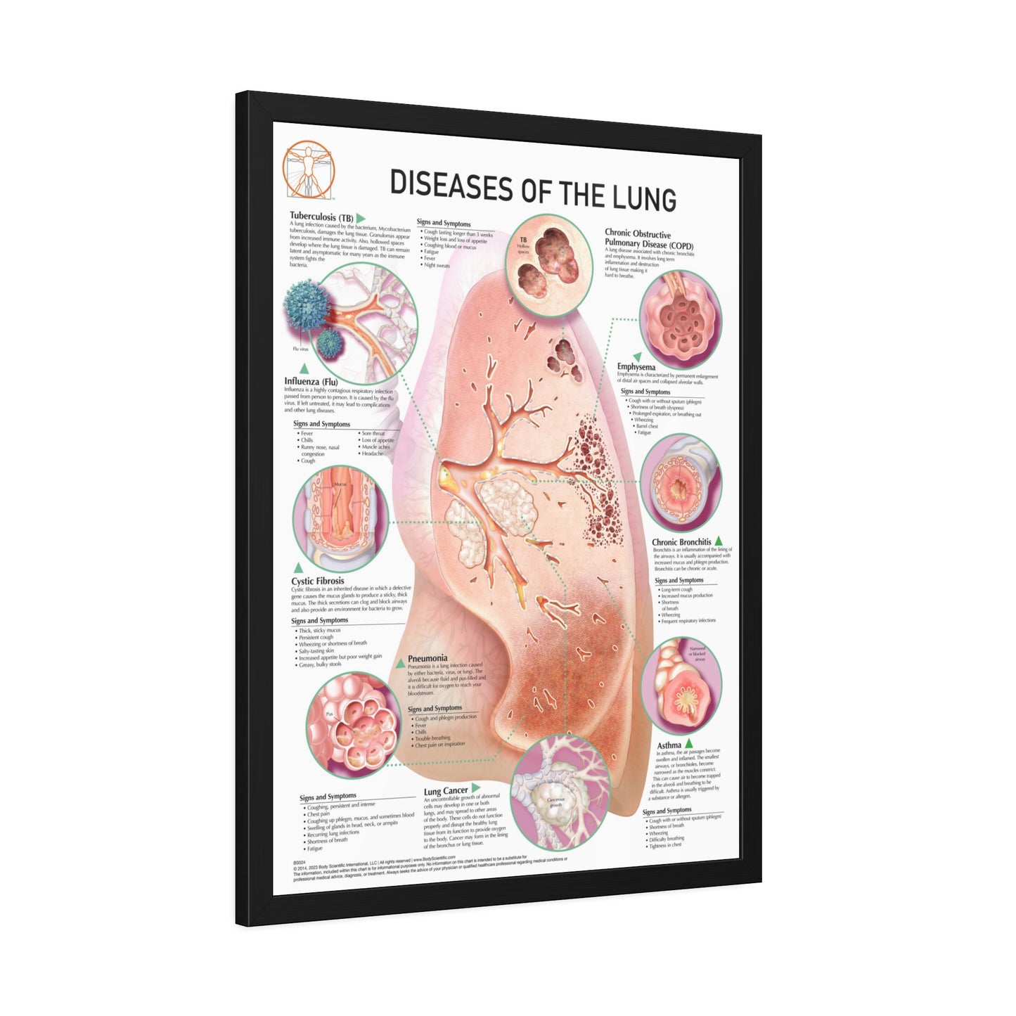 Disease of the lung