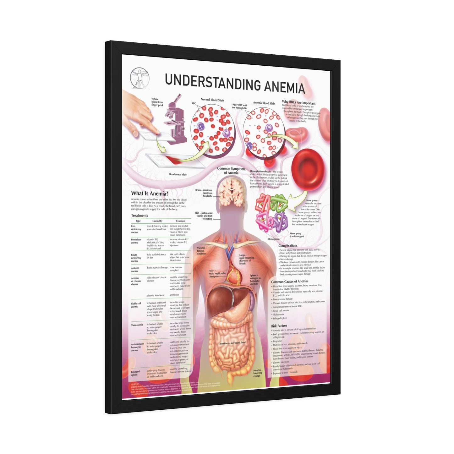 Understanding Anemia