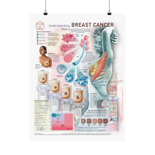 Understanding Breast Cancer