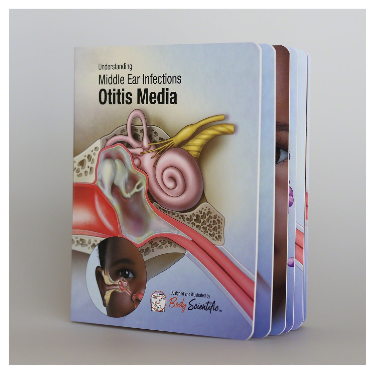 Otitis Media Board Book: Essential Ear Anatomy and Infection Guide