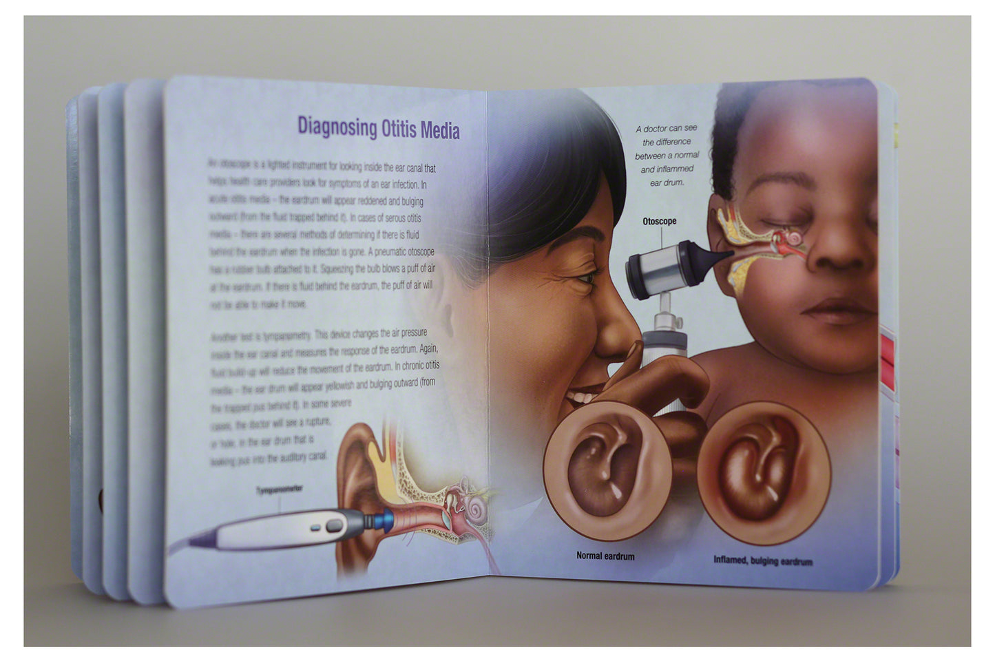 Otitis Media Board Book: Essential Ear Anatomy and Infection Guide