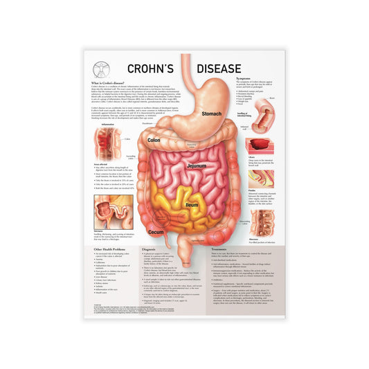 Chron's Disease - Decal