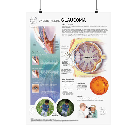 Understanding Glaucoma