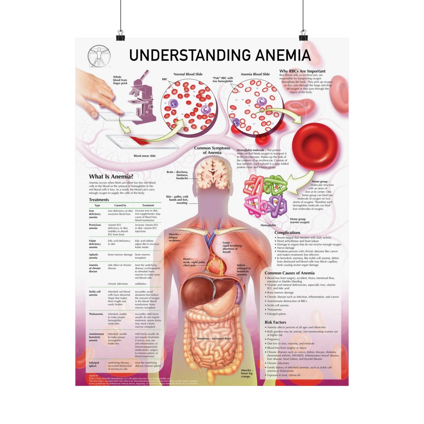 Understanding Anemia