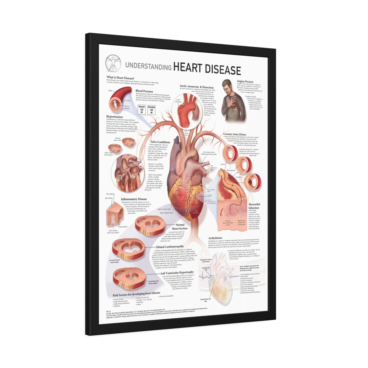 Understanding Heart Disease