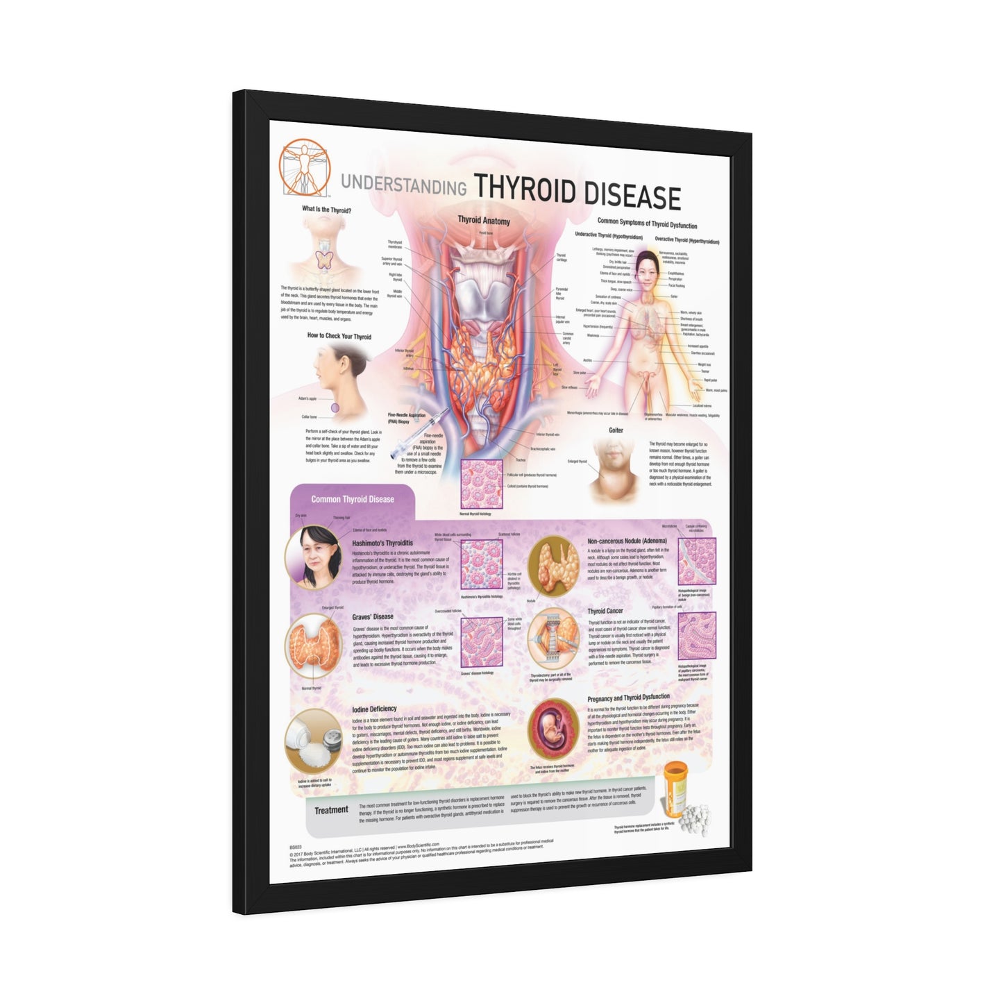 Understanding Thyroid Disease