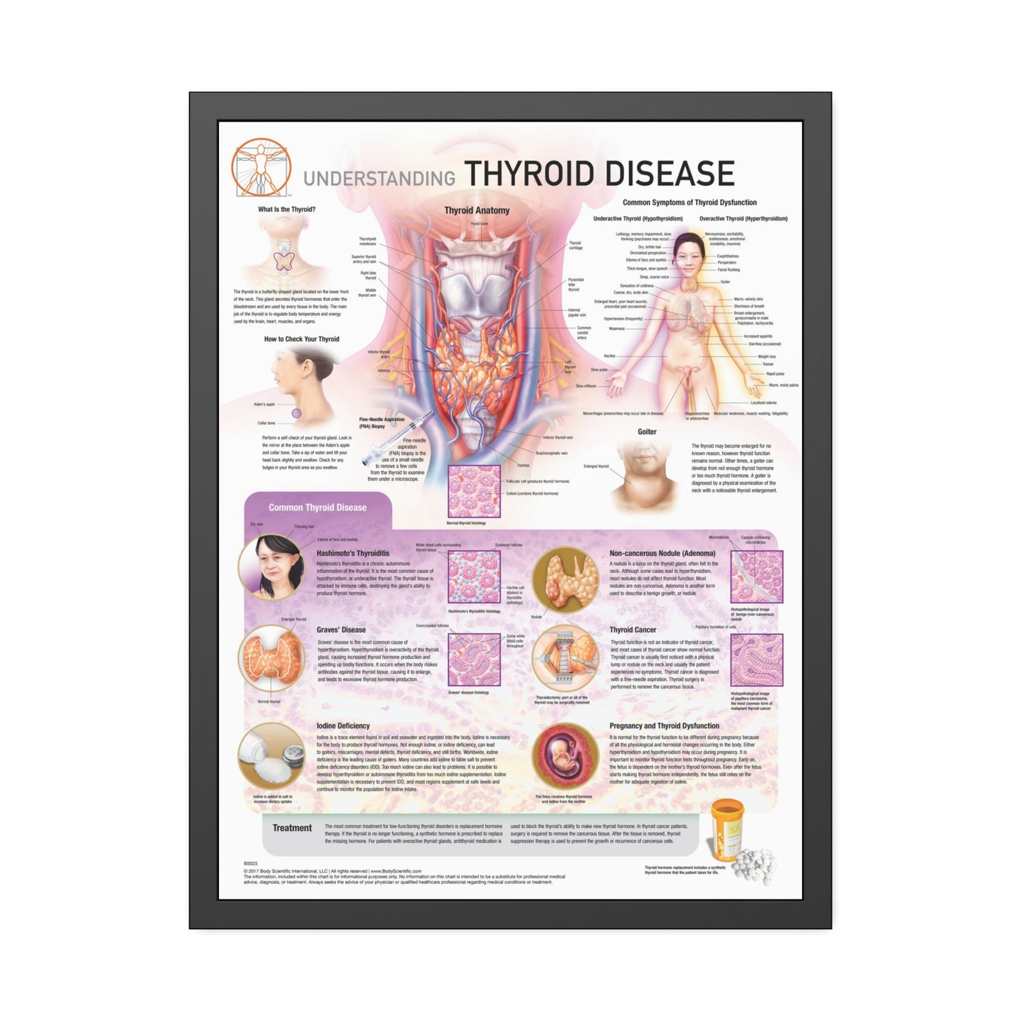 Understanding Thyroid Disease