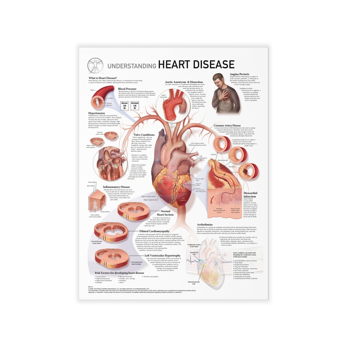 Understanding Heart Disease - Decal