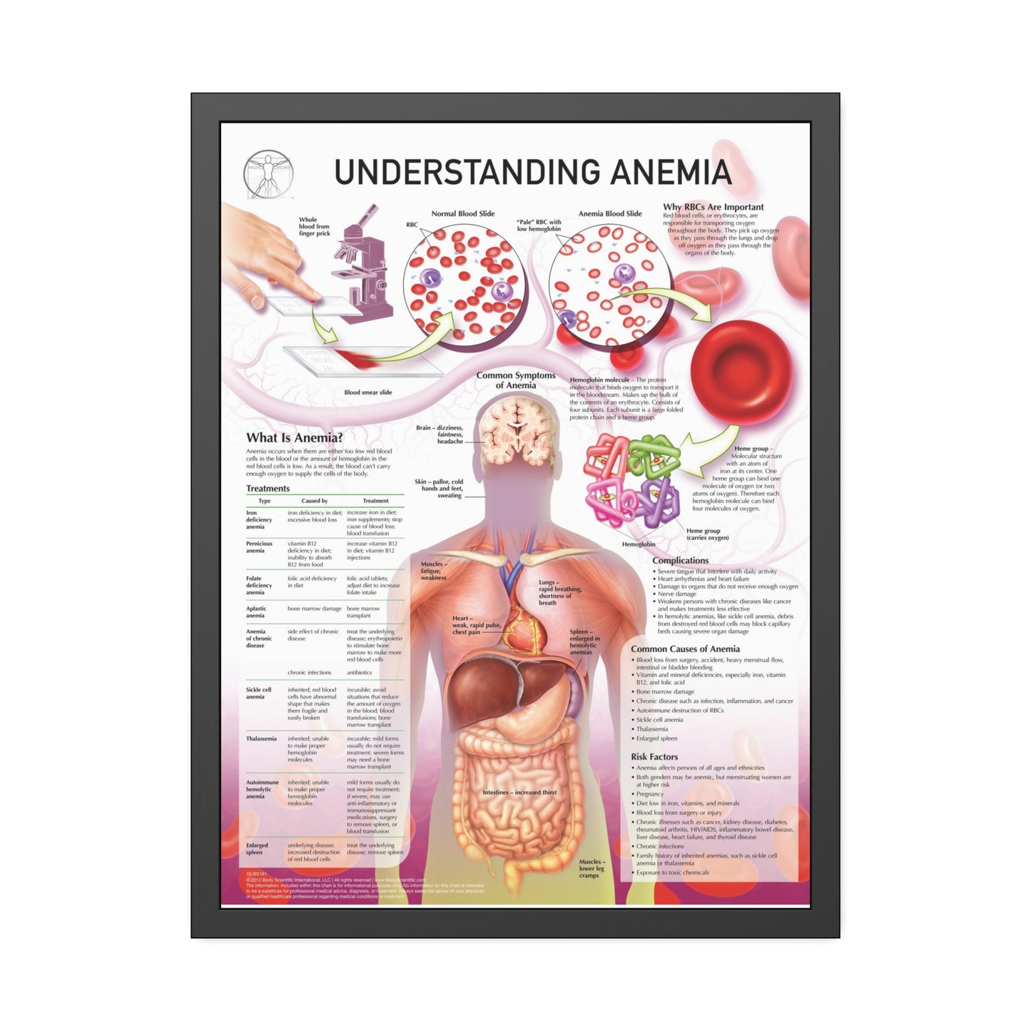 Understanding Anemia