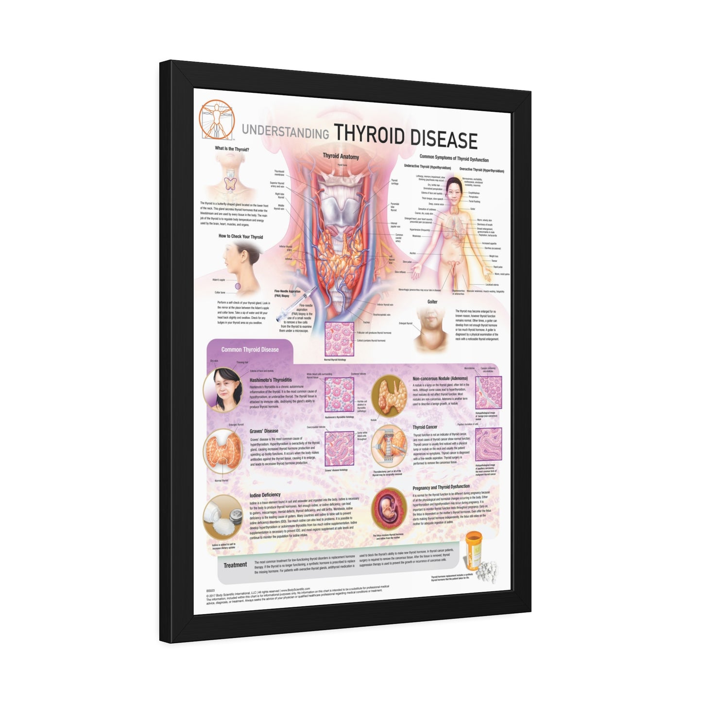 Understanding Thyroid Disease