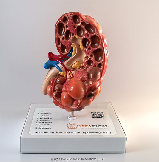 ADPKD Kidney