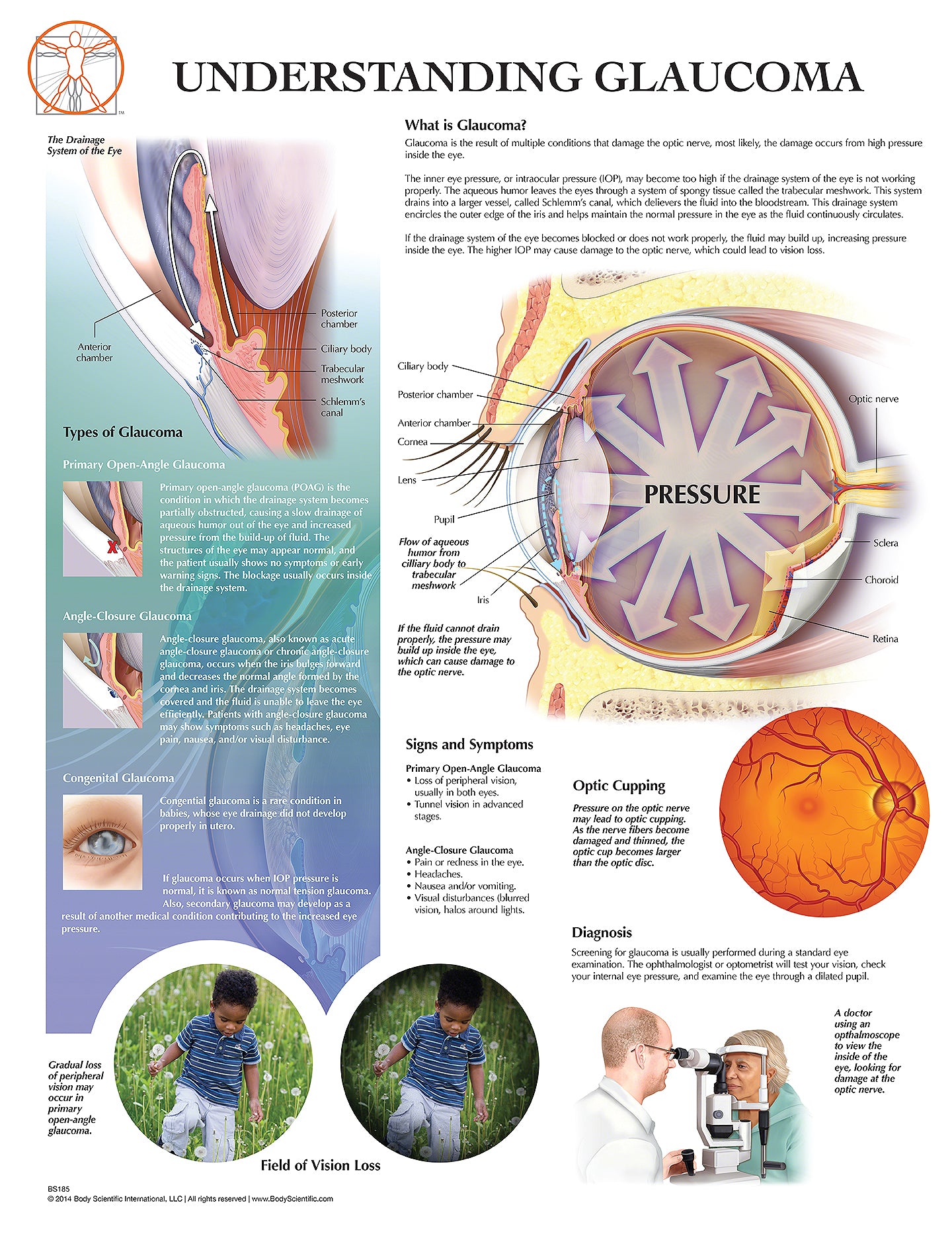 Glaucoma Eye Drop Charts